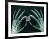 Skeletal Hands Holding Barcode-Thom Lang-Framed Photographic Print