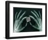 Skeletal Hands Holding Barcode-Thom Lang-Framed Photographic Print