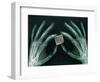 Skeletal Hands Holding Barcode-Thom Lang-Framed Photographic Print