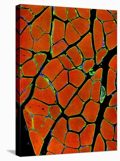 Skeletal Muscle Fibres, Light Micrograph-Thomas Deerinck-Stretched Canvas