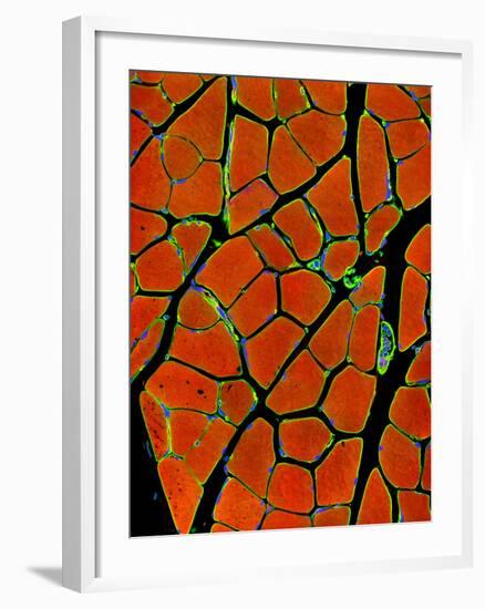 Skeletal Muscle Fibres, Light Micrograph-Thomas Deerinck-Framed Photographic Print