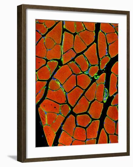 Skeletal Muscle Fibres, Light Micrograph-Thomas Deerinck-Framed Photographic Print