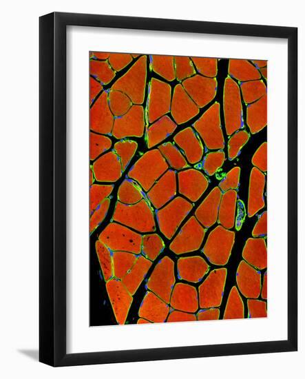 Skeletal Muscle Fibres, Light Micrograph-Thomas Deerinck-Framed Photographic Print