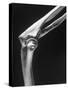 Skeletal Structures of an Elbow, Showing Joint-Andreas Feininger-Stretched Canvas