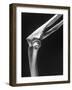 Skeletal Structures of an Elbow, Showing Joint-Andreas Feininger-Framed Photographic Print
