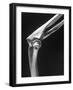 Skeletal Structures of an Elbow, Showing Joint-Andreas Feininger-Framed Photographic Print