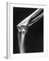 Skeletal Structures of an Elbow, Showing Joint-Andreas Feininger-Framed Photographic Print