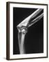 Skeletal Structures of an Elbow, Showing Joint-Andreas Feininger-Framed Photographic Print