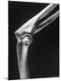 Skeletal Structures of an Elbow, Showing Joint-Andreas Feininger-Mounted Photographic Print