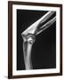 Skeletal Structures of an Elbow, Showing Joint-Andreas Feininger-Framed Photographic Print