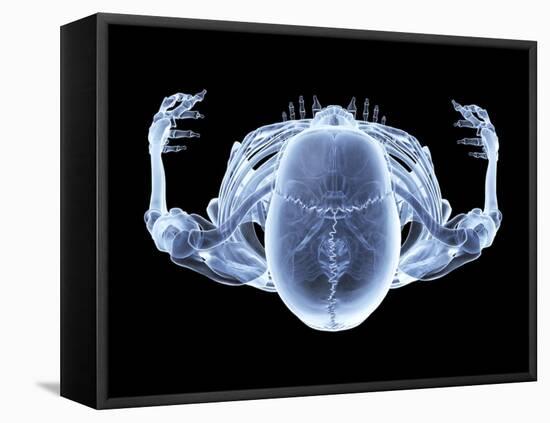 Skeleton From Above, X-ray Artwork-David Mack-Framed Stretched Canvas