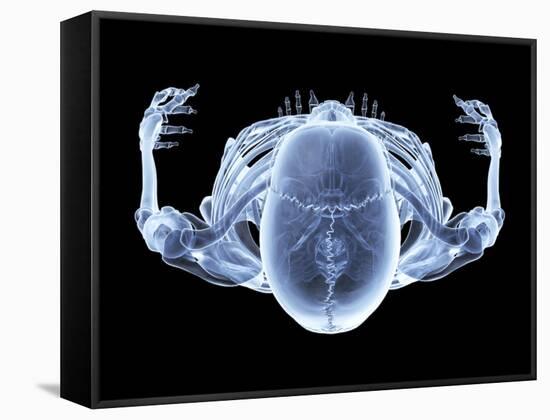 Skeleton From Above, X-ray Artwork-David Mack-Framed Stretched Canvas