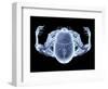 Skeleton From Above, X-ray Artwork-David Mack-Framed Premium Photographic Print