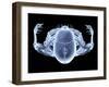 Skeleton From Above, X-ray Artwork-David Mack-Framed Premium Photographic Print