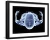 Skeleton From Above, X-ray Artwork-David Mack-Framed Premium Photographic Print