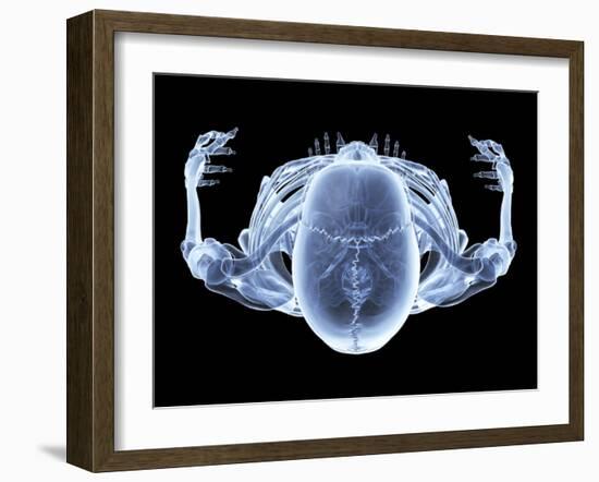 Skeleton From Above, X-ray Artwork-David Mack-Framed Photographic Print