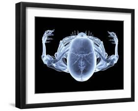 Skeleton From Above, X-ray Artwork-David Mack-Framed Photographic Print