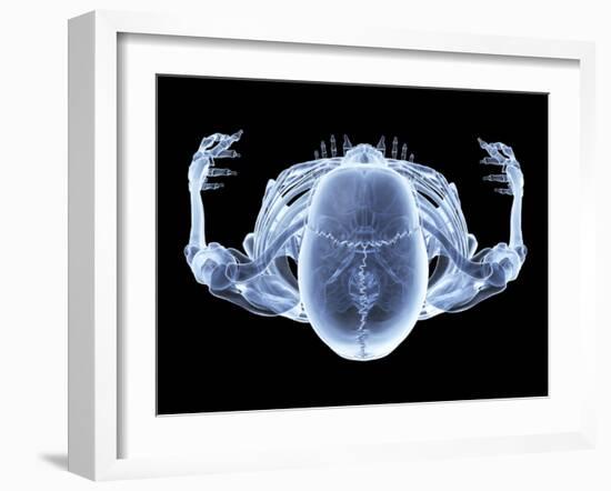 Skeleton From Above, X-ray Artwork-David Mack-Framed Photographic Print