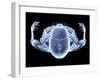 Skeleton From Above, X-ray Artwork-David Mack-Framed Photographic Print