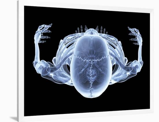 Skeleton From Above, X-ray Artwork-David Mack-Framed Photographic Print