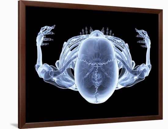 Skeleton From Above, X-ray Artwork-David Mack-Framed Photographic Print