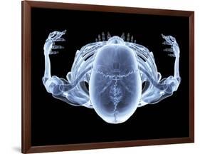 Skeleton From Above, X-ray Artwork-David Mack-Framed Photographic Print