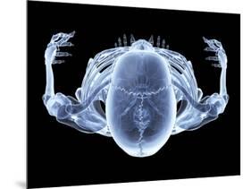 Skeleton From Above, X-ray Artwork-David Mack-Mounted Photographic Print