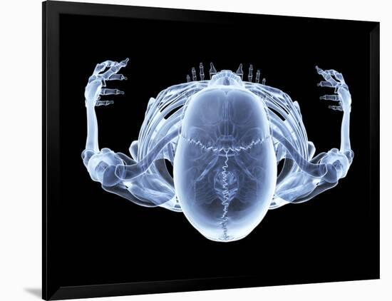 Skeleton From Above, X-ray Artwork-David Mack-Framed Photographic Print