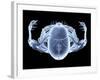 Skeleton From Above, X-ray Artwork-David Mack-Framed Photographic Print