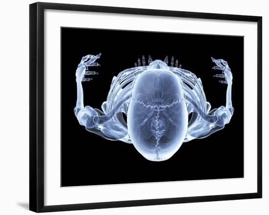 Skeleton From Above, X-ray Artwork-David Mack-Framed Photographic Print