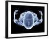 Skeleton From Above, X-ray Artwork-David Mack-Framed Photographic Print