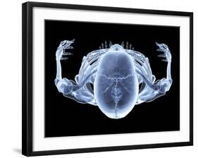 Skeleton From Above, X-ray Artwork-David Mack-Framed Photographic Print