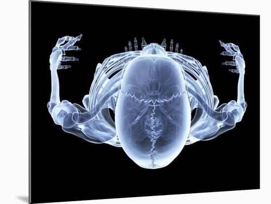 Skeleton From Above, X-ray Artwork-David Mack-Mounted Photographic Print