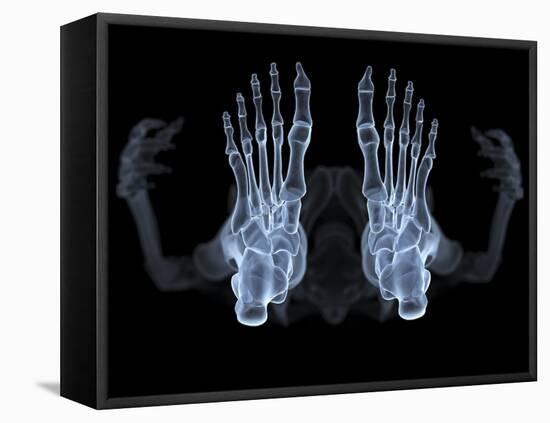 Skeleton From Below, X-ray Artwork-David Mack-Framed Stretched Canvas