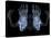 Skeleton From Below, X-ray Artwork-David Mack-Stretched Canvas