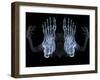 Skeleton From Below, X-ray Artwork-David Mack-Framed Premium Photographic Print