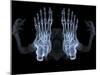 Skeleton From Below, X-ray Artwork-David Mack-Mounted Premium Photographic Print