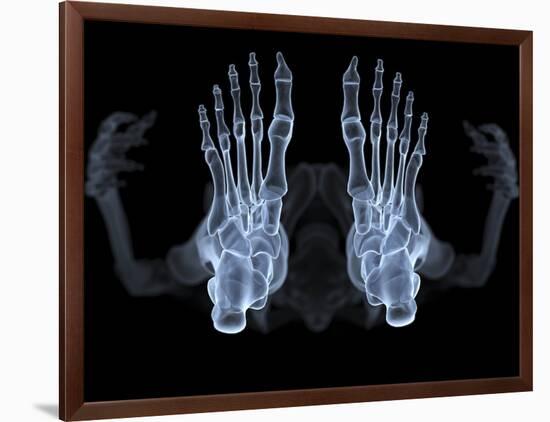 Skeleton From Below, X-ray Artwork-David Mack-Framed Photographic Print