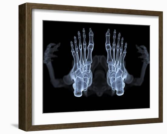 Skeleton From Below, X-ray Artwork-David Mack-Framed Photographic Print