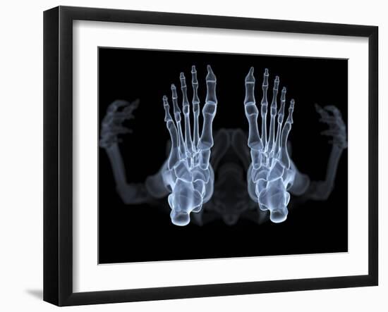 Skeleton From Below, X-ray Artwork-David Mack-Framed Photographic Print