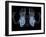 Skeleton From Below, X-ray Artwork-David Mack-Framed Photographic Print