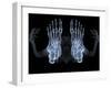 Skeleton From Below, X-ray Artwork-David Mack-Framed Photographic Print