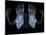 Skeleton From Below, X-ray Artwork-David Mack-Mounted Photographic Print