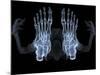 Skeleton From Below, X-ray Artwork-David Mack-Mounted Photographic Print