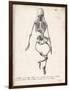 Skeleton of an Adult Patient Afflicted with Rickets-Langlume-Framed Art Print