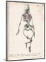 Skeleton of an Adult Patient Afflicted with Rickets-Langlume-Mounted Art Print