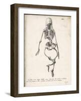 Skeleton of an Adult Patient Afflicted with Rickets-Langlume-Framed Art Print