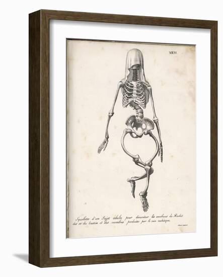 Skeleton of an Adult Patient Afflicted with Rickets-Langlume-Framed Art Print