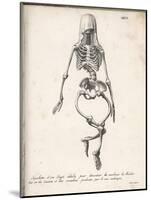 Skeleton of an Adult Patient Afflicted with Rickets-Langlume-Mounted Art Print