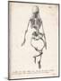 Skeleton of an Adult Patient Afflicted with Rickets-Langlume-Mounted Art Print